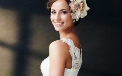 Composite Veneers For Fluorosis in Hoppers Crossing