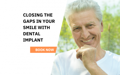 Which Implants Are Safest In Hoppers Crossing?