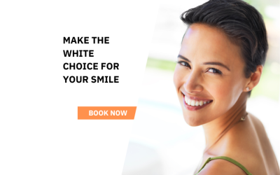 The Ultimate Veneers FAQ: Answering Your Most Pressing Questions